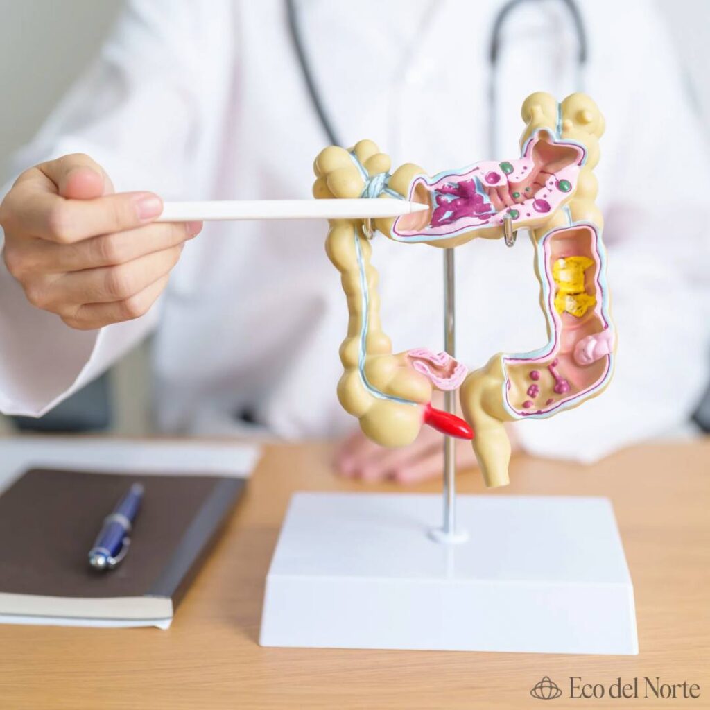 5. 15-dic-24 Aumento De Cáncer Intestinal En Adultos Jóvenes Preocupa A Expertos